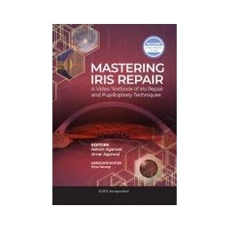 Mastering Iris Repair: A Video Textbook of Iris Repair and Pupilloplasty Techniques
