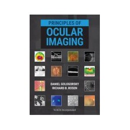 Principles of Ocular Imaging