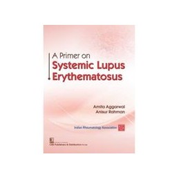 A Primer on Systemic Lupus Erythematosus