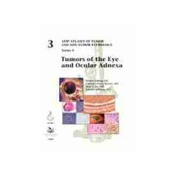 Tumors of the Eye and...