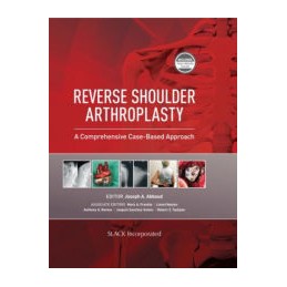 Reverse Shoulder...