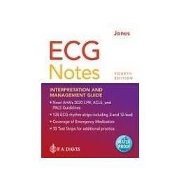 ECG Notes: Interpretation and Management Guide