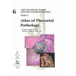 Atlas of Placental Pathology