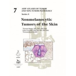 Nonmelanocytic Tumors of...