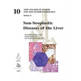 Non-Neoplastic Diseases of the Liver