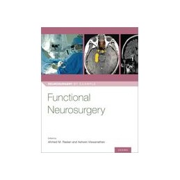 Functional Neurosurgery