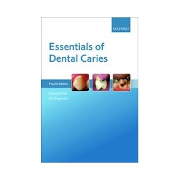 Essentials of Dental Caries