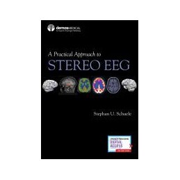 A Practical Approach to Stereo EEG