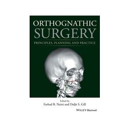 Orthognathic Surgery:...