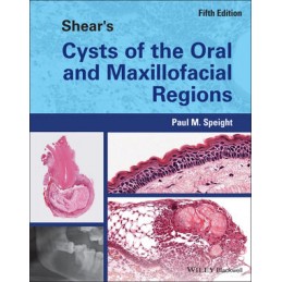 Shear's Cysts of the Oral...