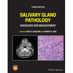 Salivary Gland Pathology:...