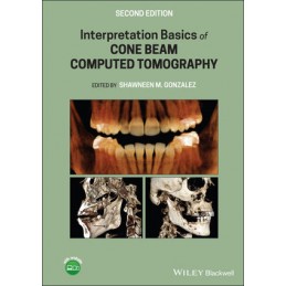 Interpretation Basics of Cone Beam Computed Tomography, 2nd Edition