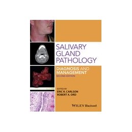 Salivary Gland Pathology:...