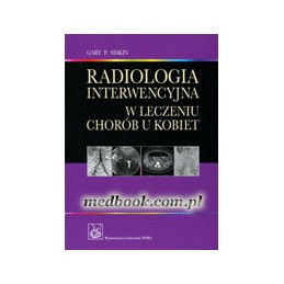 Radiologia interwencyjna w leczeniu chorób u kobiet