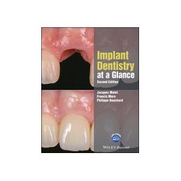 Implant Dentistry at a Glance