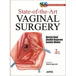 State-of-the-Art Vaginal Surgery