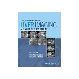 Liver Imaging: MRI with CT...