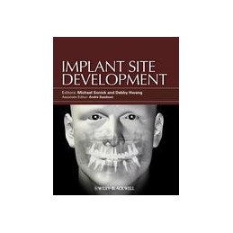 Implant Site Development