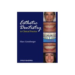 Esthetic Dentistry in Clinical Practice