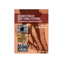 Disinfection of Root Canal...