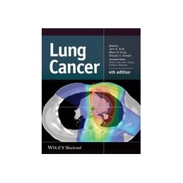 Lung Cancer