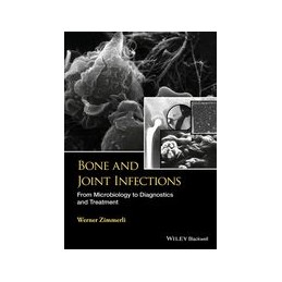 Bone and Joint Infections:...