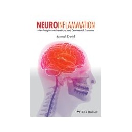 Neuroinflammation: New...