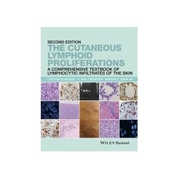 The Cutaneous Lymphoid Proliferations: A Comprehensive Textbook of Lymphocytic Infiltrates of the Skin