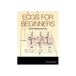 ECGs for Beginners