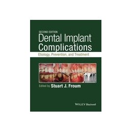 Dental Implant...
