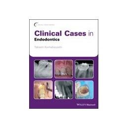 Clinical Cases in Endodontics