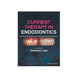 Current Therapy in Endodontics