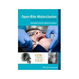 Open-Bite Malocclusion:...