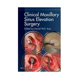 Clinical Maxillary Sinus...