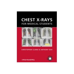 Chest X-rays for Medical...
