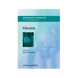 Fibroids