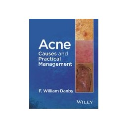 Acne: Causes and Practical...