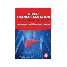 Liver Transplantation:...