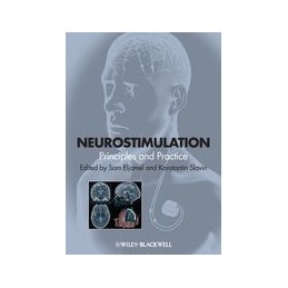 Neurostimulation:...