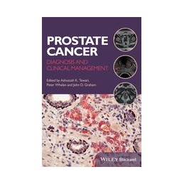 Prostate Cancer: Diagnosis...