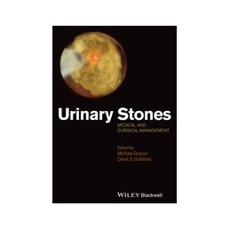 Urinary Stones: Medical and...