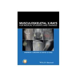 Musculoskeletal X-Rays for...