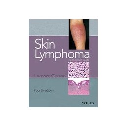 Skin Lymphoma: The...