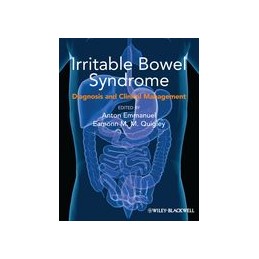 Irritable Bowel Syndrome: Diagnosis and Clinical Management