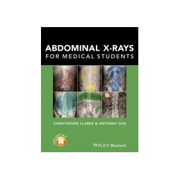 Abdominal X-rays for...