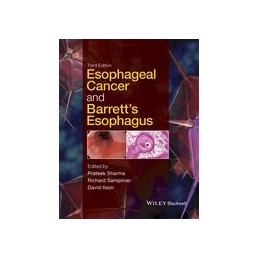 Esophageal Cancer and...