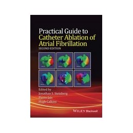 Practical Guide to Catheter Ablation of Atrial Fibrillation