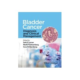 Bladder Cancer: Diagnosis...