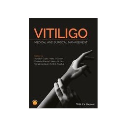 Vitiligo: Medical and...