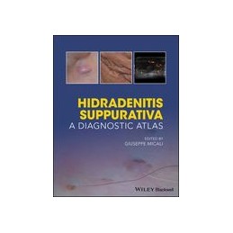 Hidradenitis Suppurativa: A...